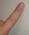 Finger.agr.jpg Finger.agr.jpg